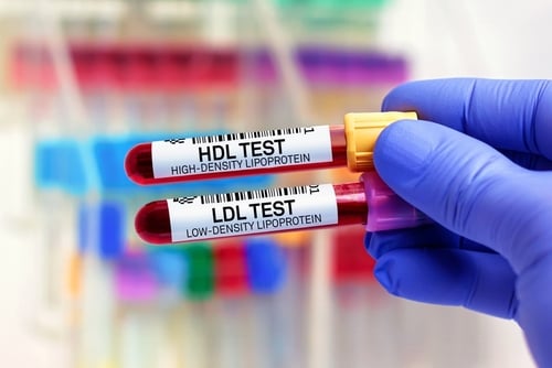 HDL2