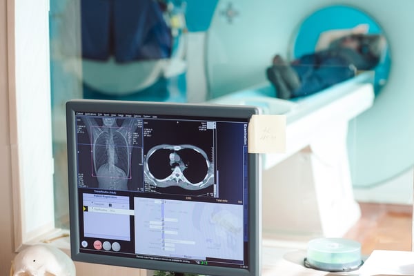 early diagnosis cancer survival rates