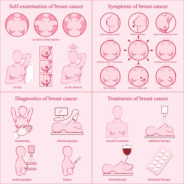 breast cancer signs and symptoms